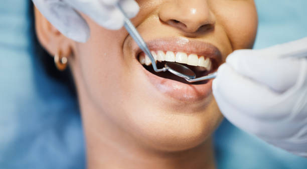Best Emergency Tooth Extraction in Tiffin, OH