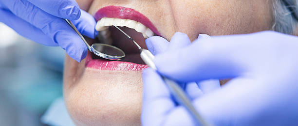Best Urgent Care for Lost Fillings or Crowns in Tiffin, OH